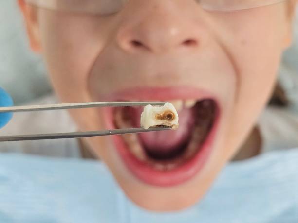 Best Emergency Treatment for Jaw Pain or Injury in Hebron, IN
